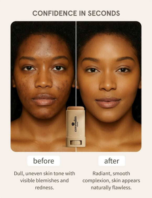 Dark Spots Make You Look 10 Years Older — This Balm Erases Them in Seconds