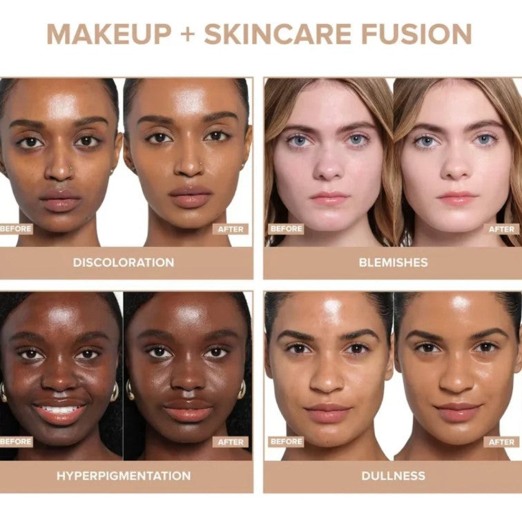 Dark Spots Make You Look 10 Years Older — This Balm Erases Them in Seconds