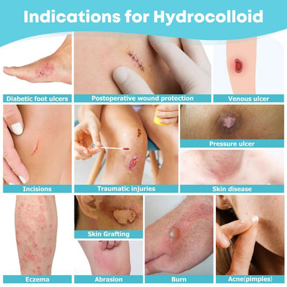 Medical grade hydrocolloid roll for - acne, bacne, ezcema and wounds