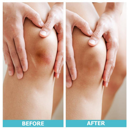 Medical grade hydrocolloid roll for - acne, bacne, ezcema and wounds