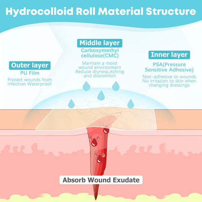 Medical grade hydrocolloid roll for - acne, bacne, ezcema and wounds